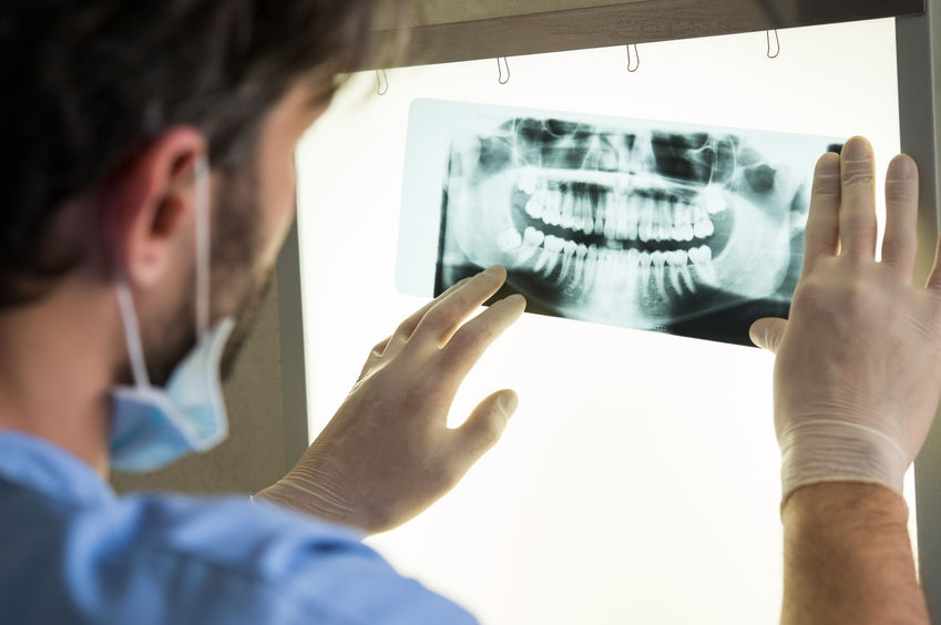 radiografia